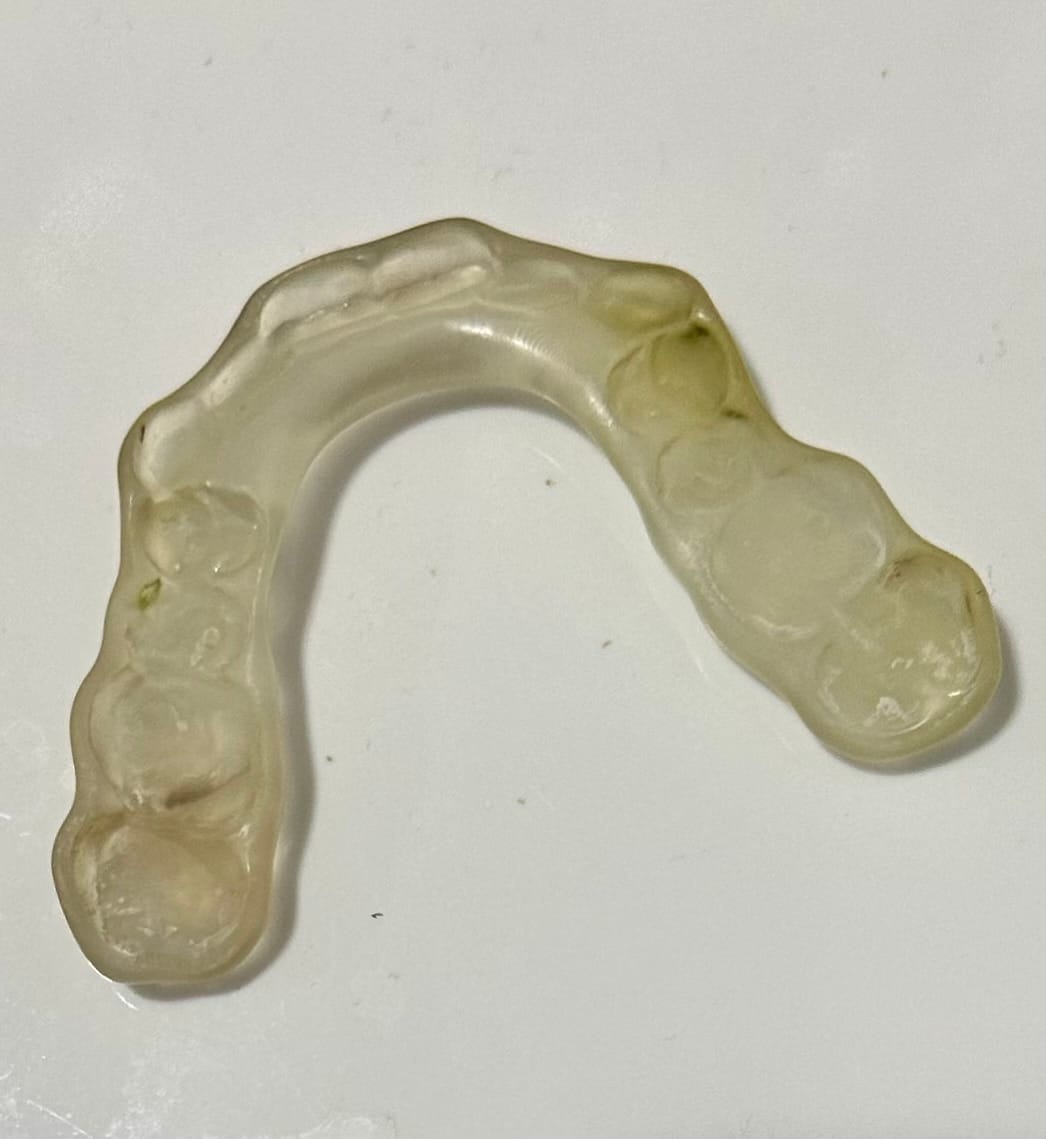 Customer photo review of Daily Retainer & Aligner Cleaner Tablets grape scented