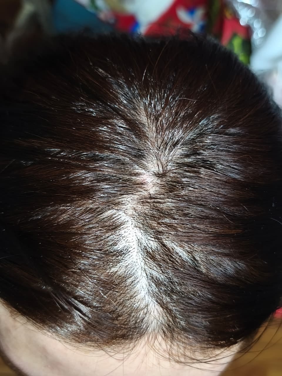 Customer photo review of Shampoo Anticaspa en barra · 70 g (XL)