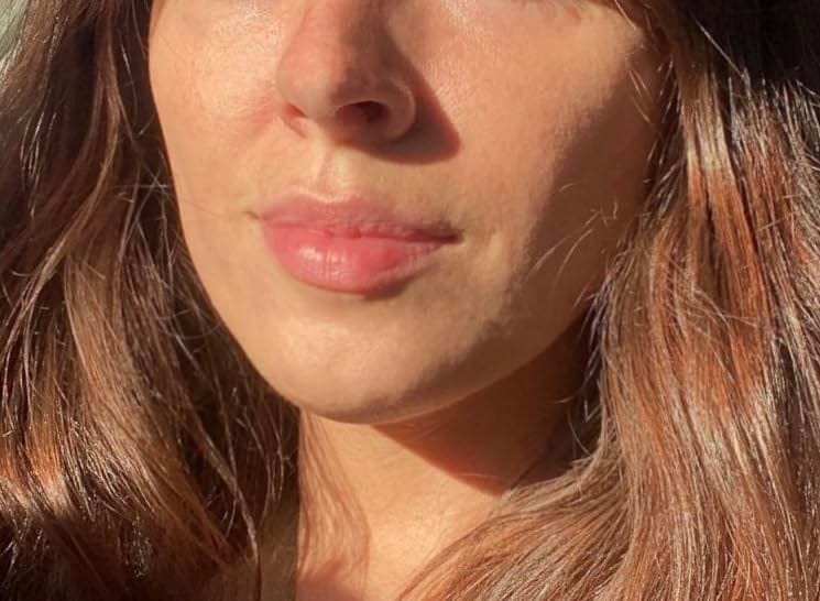 Customer photo review of Anua 77% Soothing Toner For Skin