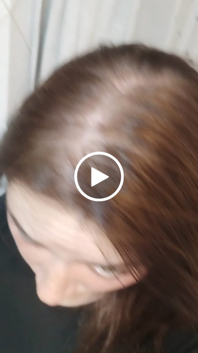 Customer video review of Shampoo Anticaspa en barra · 70 g (XL)