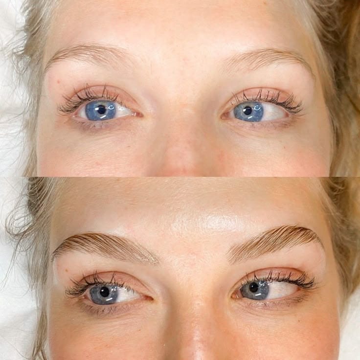 Customer photo review of Eyebrow Growth Kit
