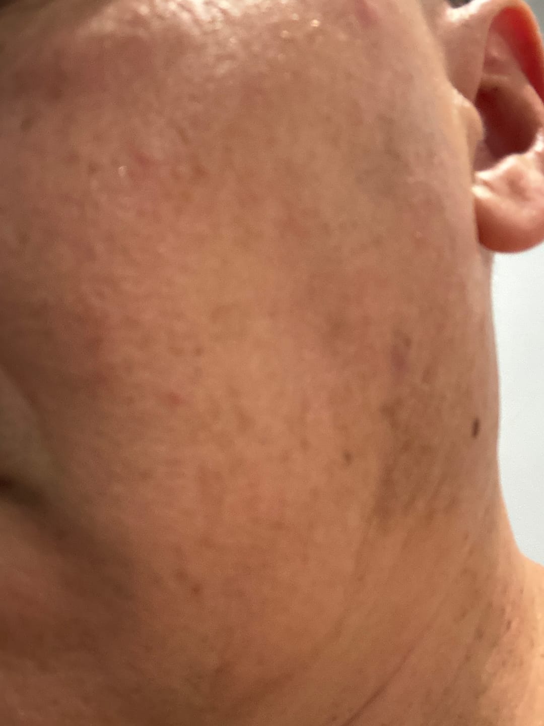 Customer photo review of Crema hidratante