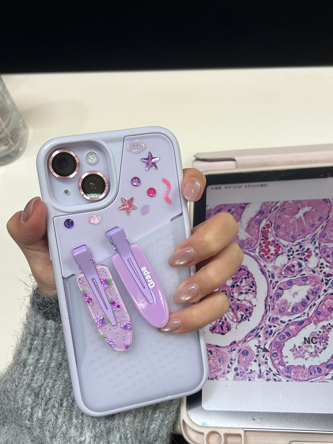 Customer photo review of Flex Pouch - iPhone 14