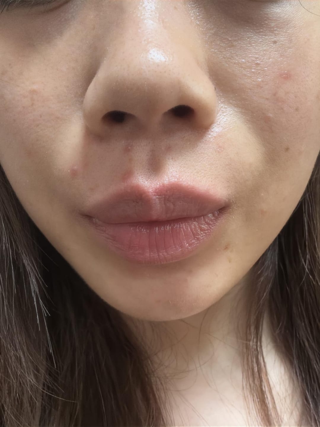 Customer photo review of Dr Althea 345 Cream