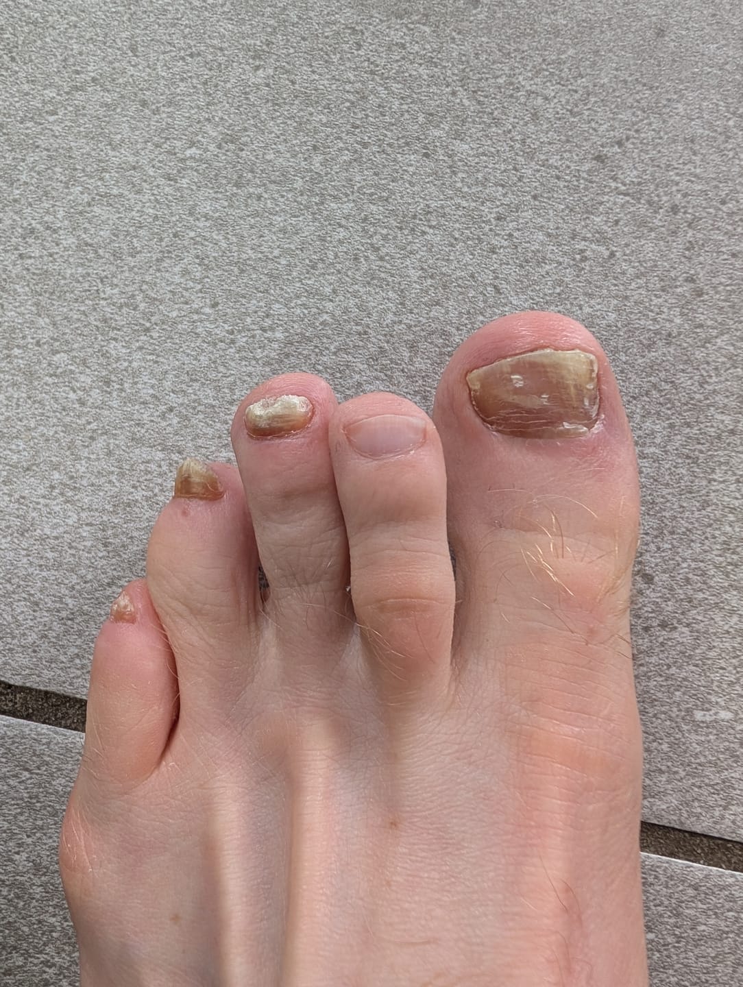 Customer photo review of Fungal Freedom