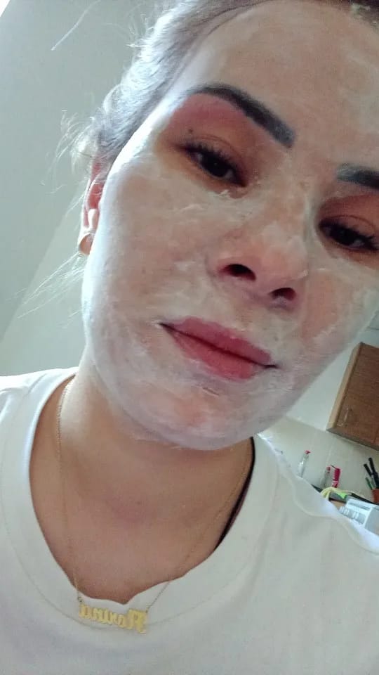 Customer photo review of Auren Cooling Clay Mask for Clear Pores