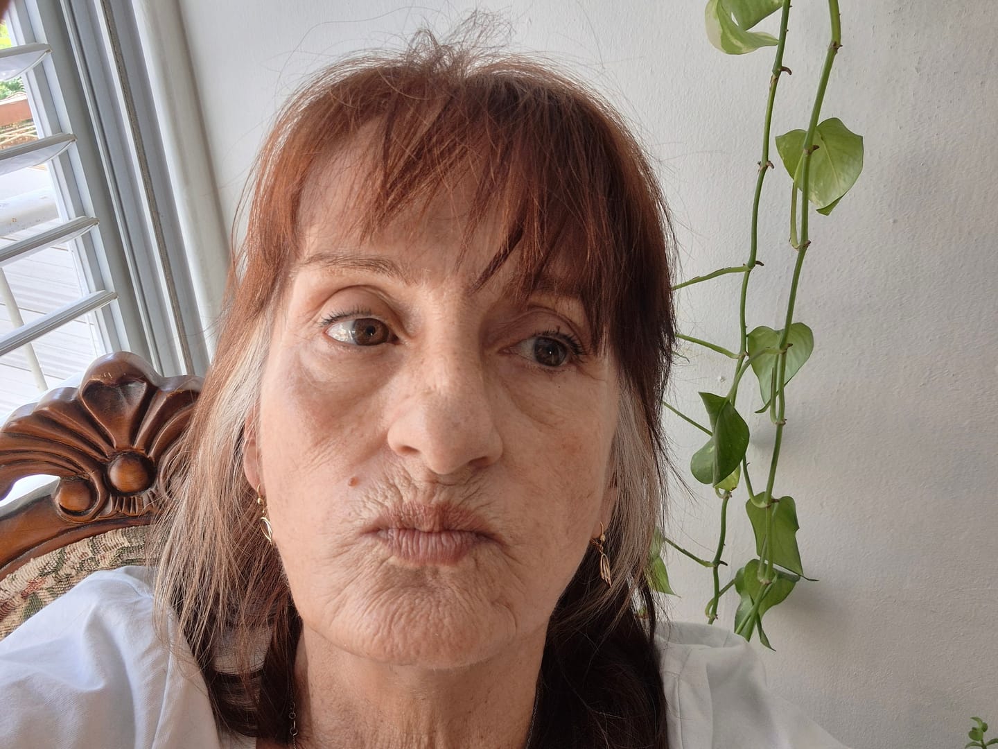 Customer photo review of שגרת PDRN קוריאנית: לעור שנראה חלק, מלא וזוהר יותר בלי מחטים ובלי טיפולים יקרים