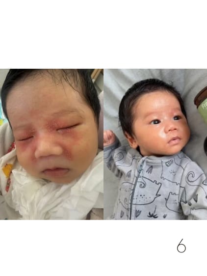 Customer photo review of Kawakawa Balm