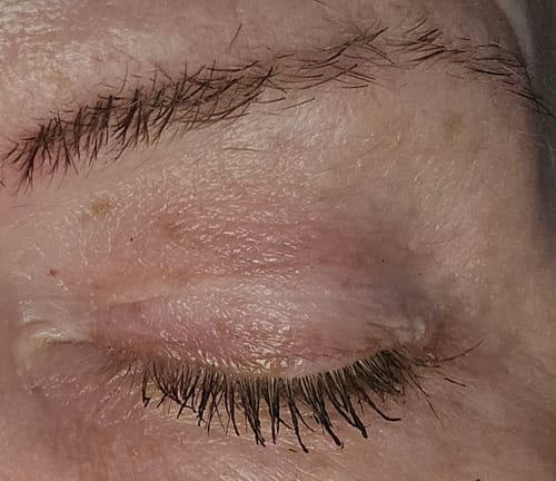 Customer photo review of Nuevo Sérum Fórmula Potenciadora (Copia)