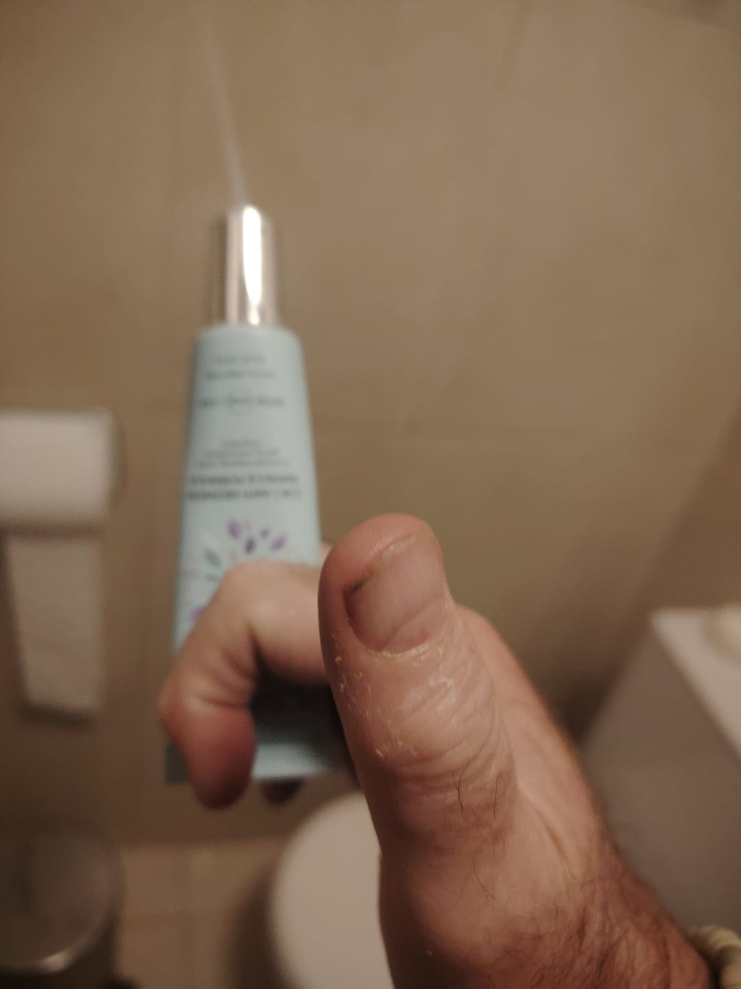 Customer photo review of Rosalique 3 in 1 Anti-Redness Miracle Formula SPF50