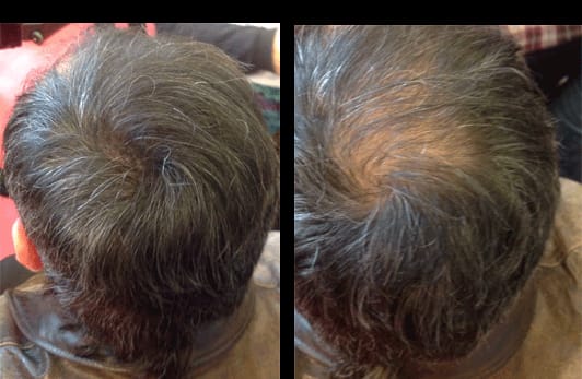 Customer photo review of HairBloom™ Korean Scalp Revival MEN