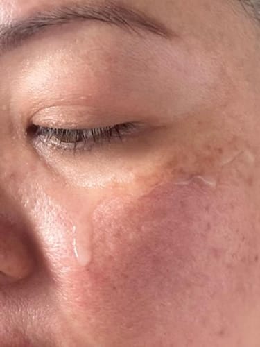 Customer photo review of Red Serum