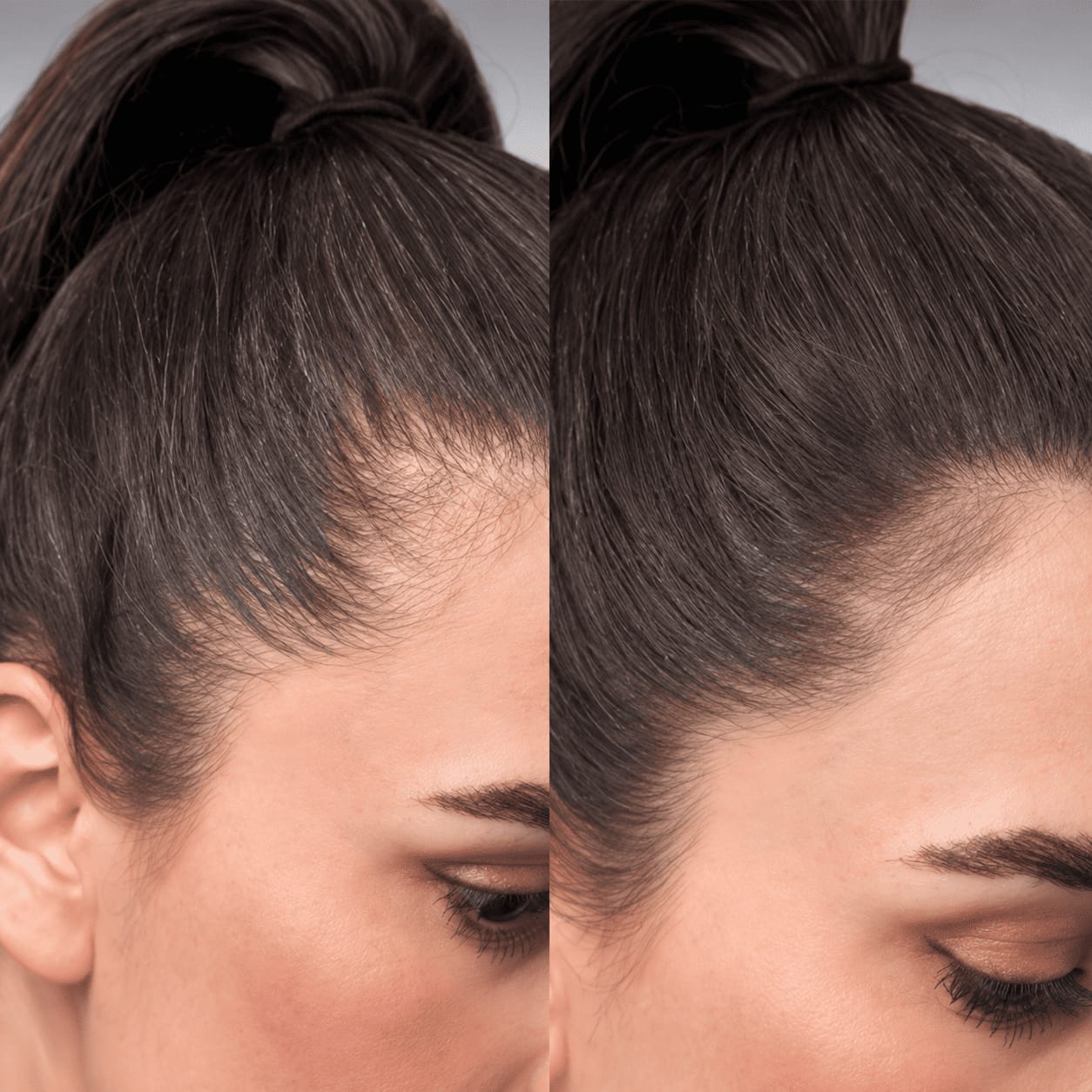 Customer photo review of Stick Corrector de Raíces y Canas