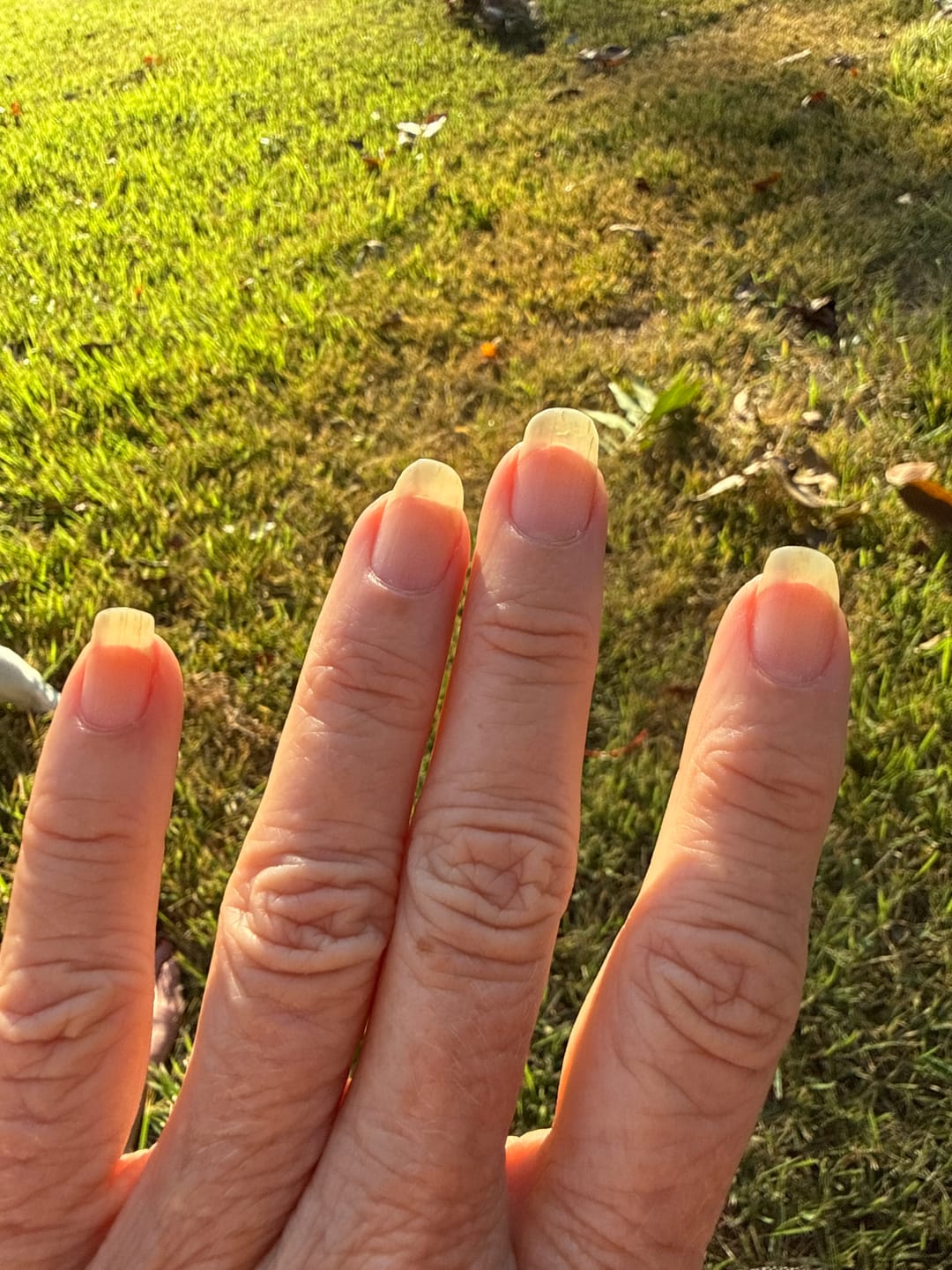 Customer photo review of Hair Skin and Nails Protocol