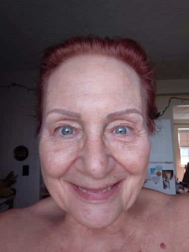 Customer's face before using The Micro Infusion System for an at-home facial treatment.