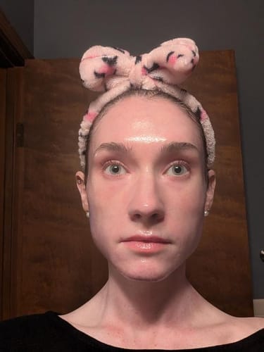 Customer photo review of [Korean Glow Maker] Glow-Up Full Facial Set
