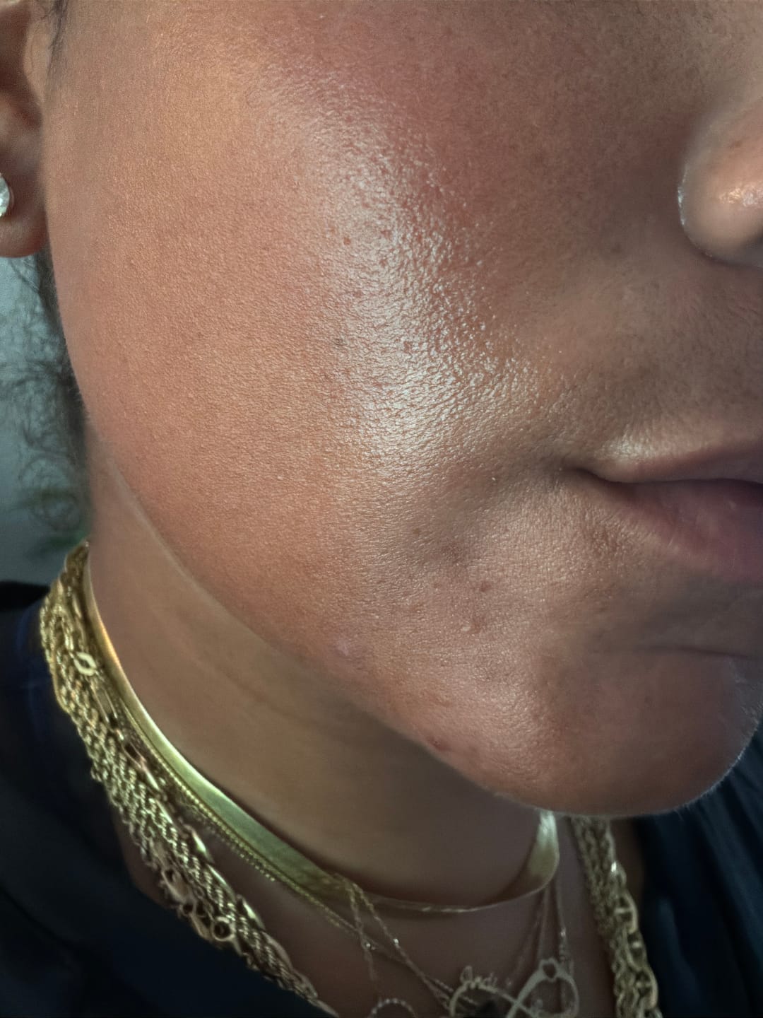 Customer photo review of Skin Formula