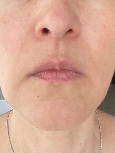 Customer photo review of TXA Niacinamide Serum