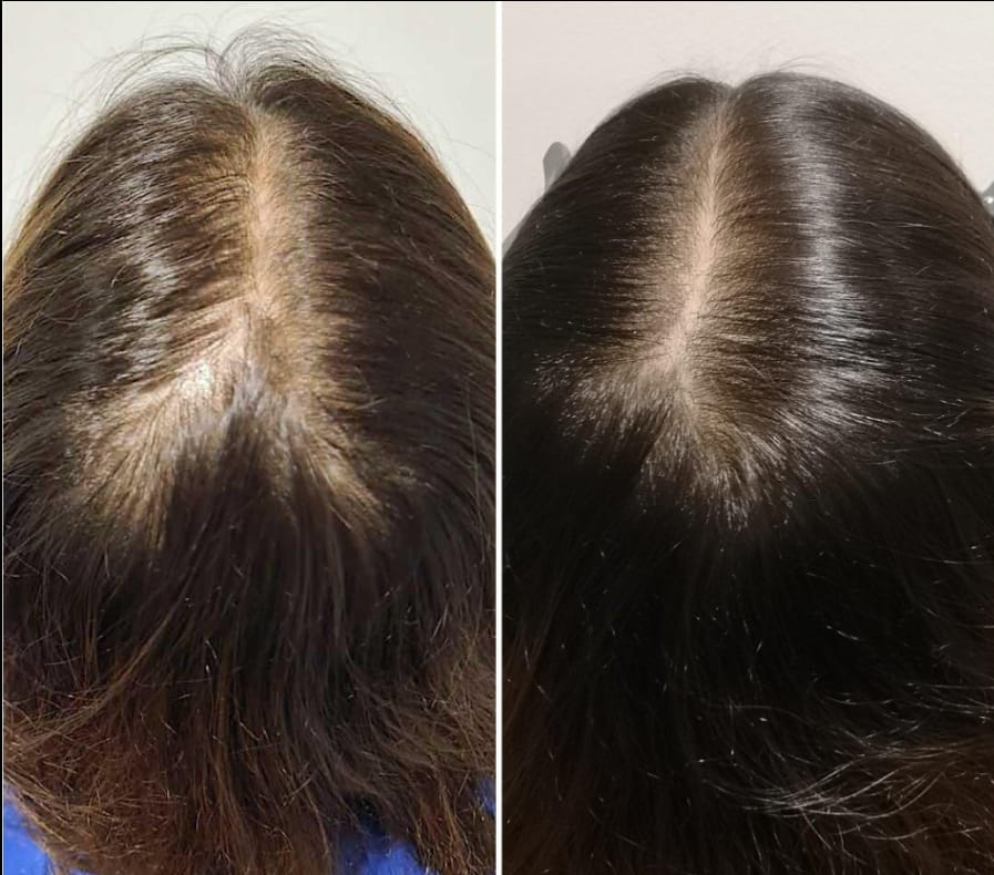 Customer photo review of HairBloom™ Korean Scalp Revival Women