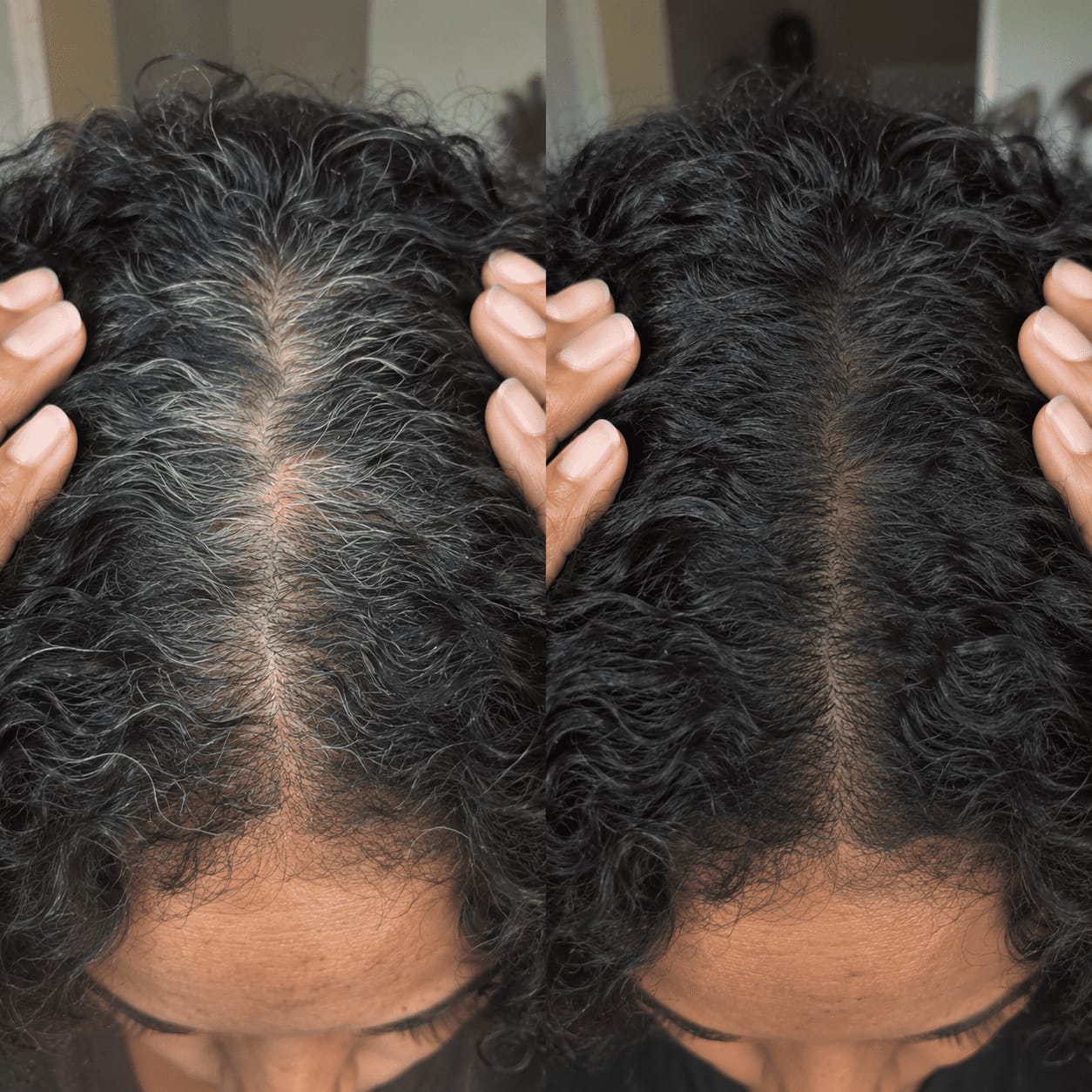 Customer photo review of Stick Corrector de Raíces y Canas