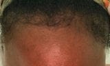Customer photo review of Huile botanique croissance+