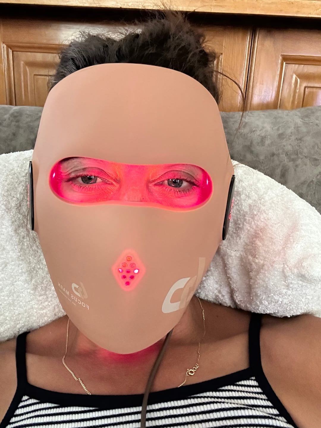 Customer photo review of JOVS 6D Laser & EMS Anti-Aging Therapy Mask
