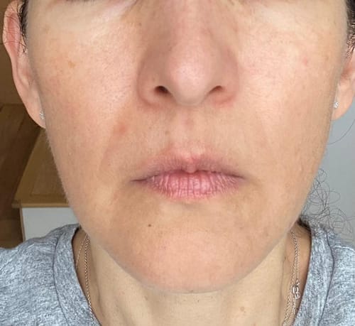 Customer photo review of Barrier Repair Glow Set (Miranda’s Barrier)