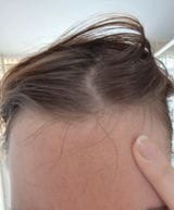 Customer photo review of Huile botanique croissance+
