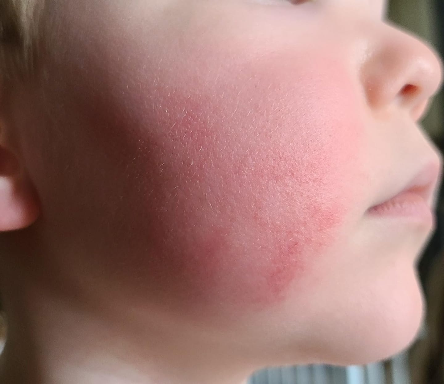 Customer photo review of Ultimate Party Pack - Face Paint for Kids