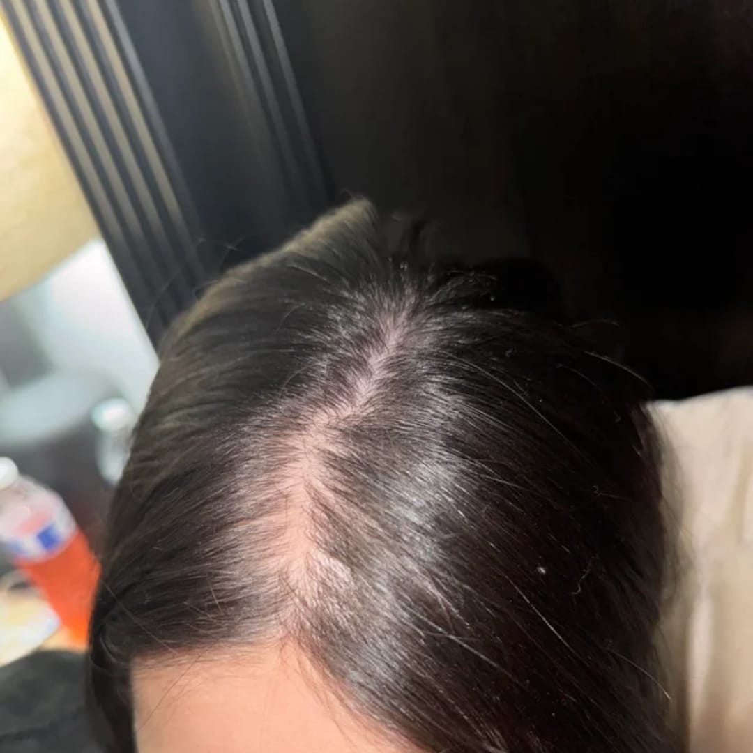 Customer photo review of HairBloom™ Korean Scalp Revival Women