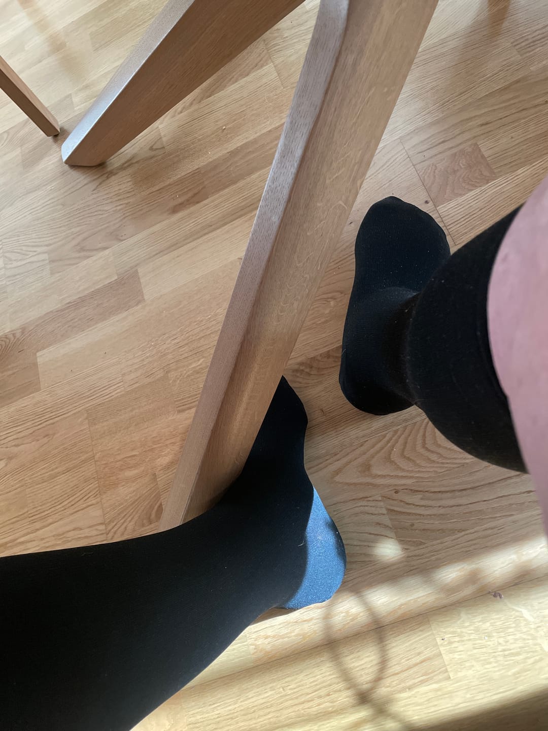 Customer photo review of Kompressionsstrümpfe Plus Size