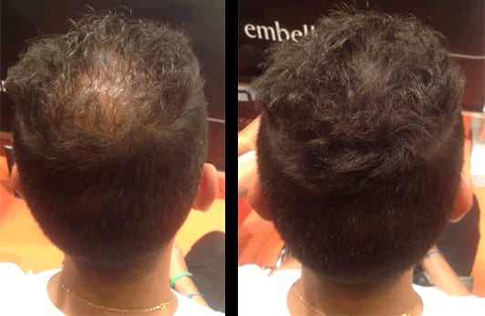 Customer photo review of HairBloom™ Korean Scalp Revival MEN