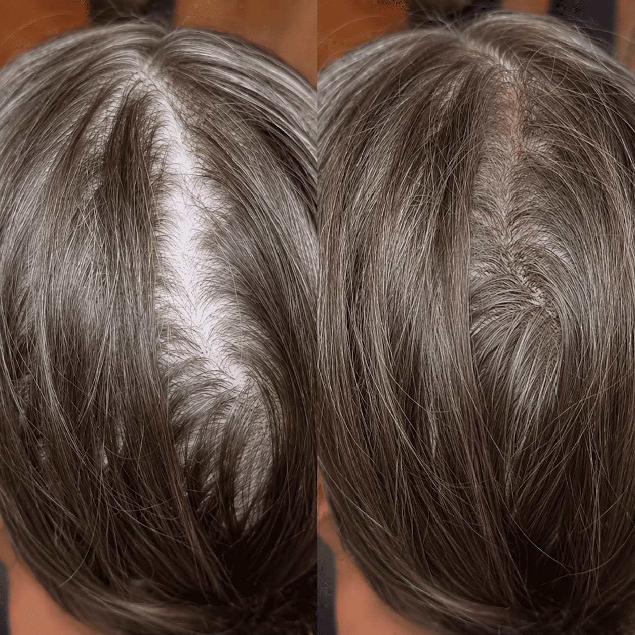 Customer photo review of Stick Corrector de Raíces y Canas