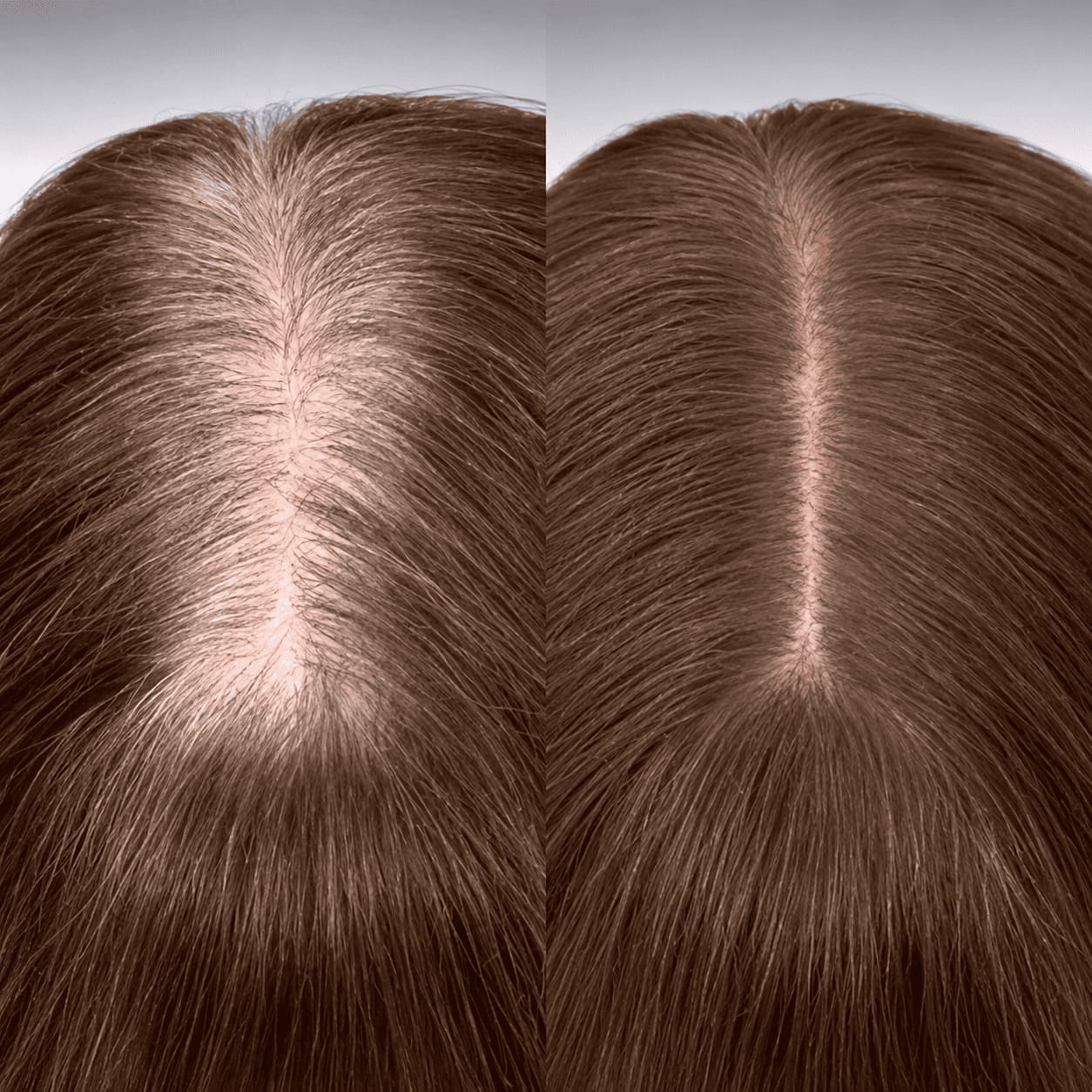 Customer photo review of Stick Corrector de Raíces y Canas