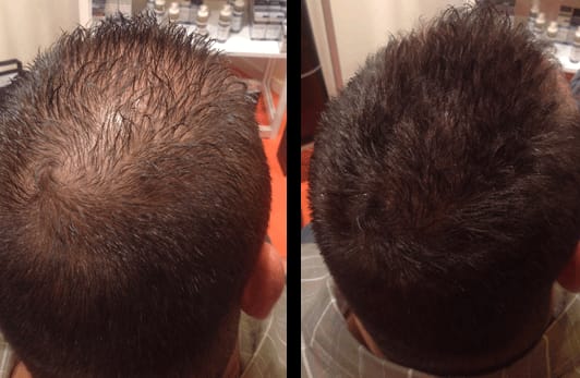 Customer photo review of HairBloom™ Korean Scalp Revival MEN