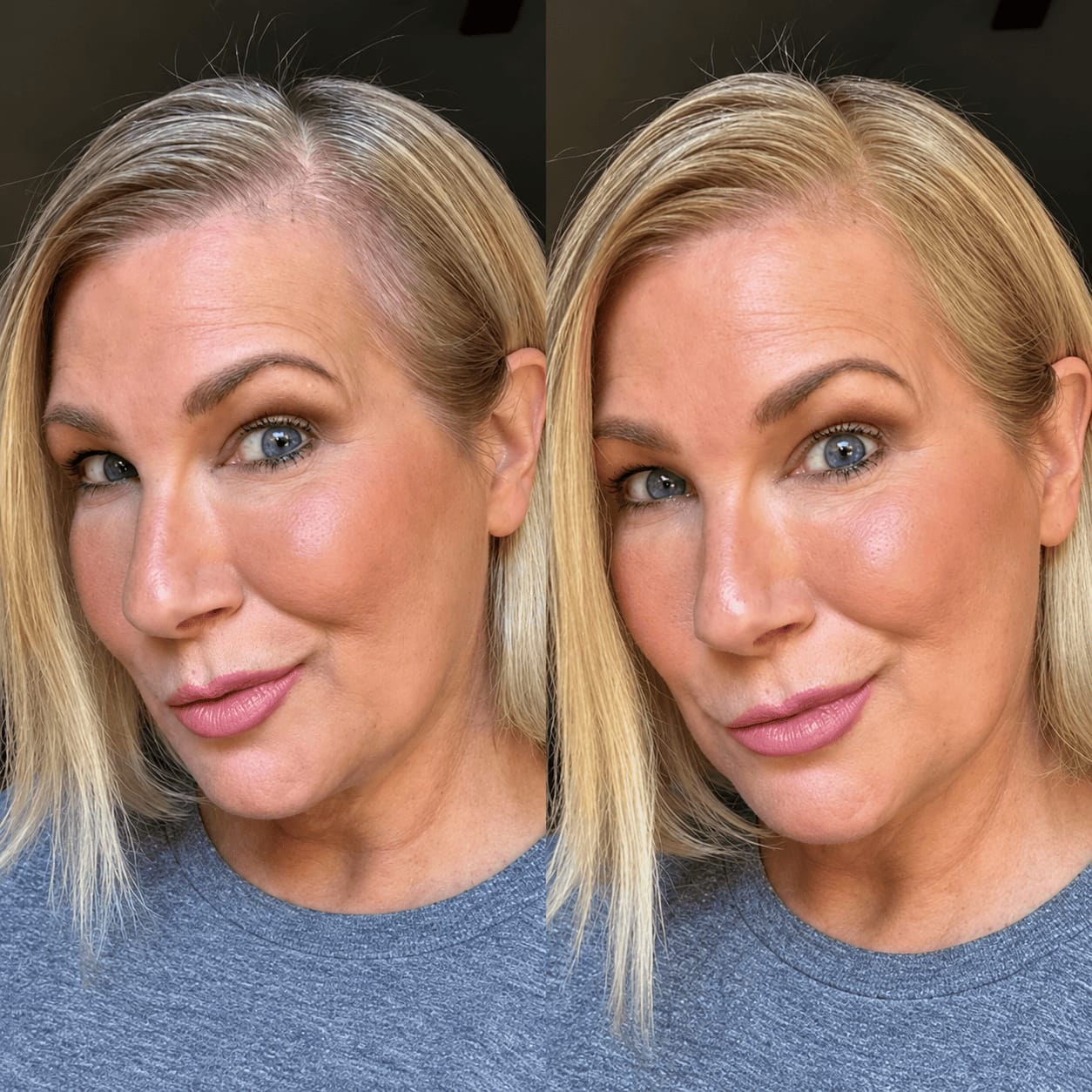 Customer photo review of Stick Corrector de Raíces y Canas