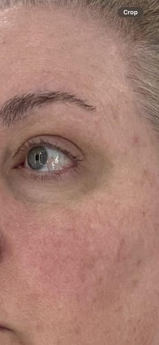 Customer photo review of Barrier Repair Glow Set (Miranda’s Barrier)