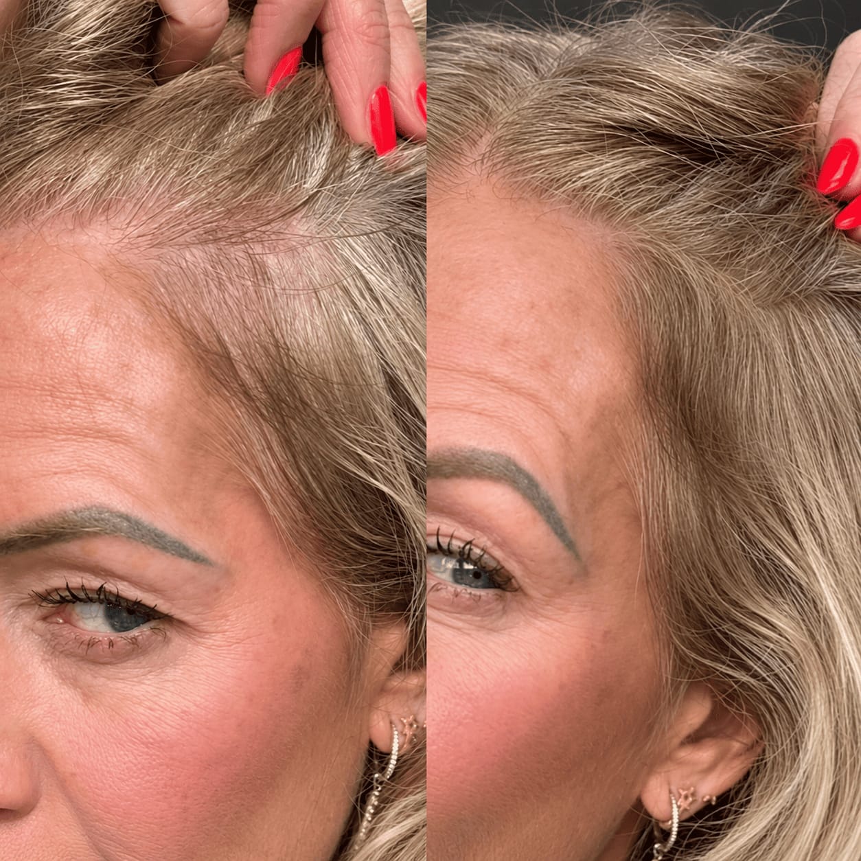 Customer photo review of Stick Corrector de Raíces y Canas