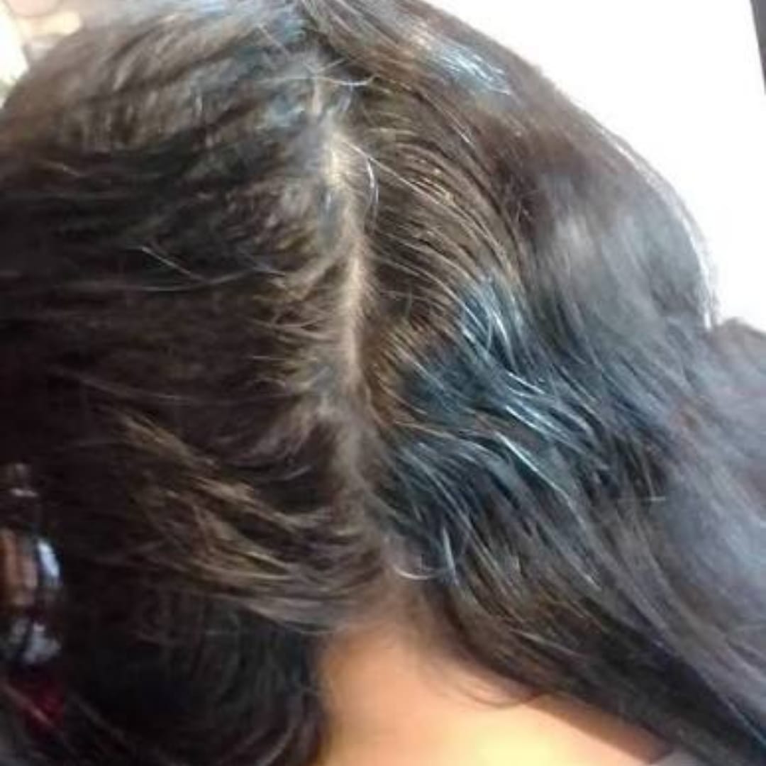 Customer photo review of HairBloom™ Korean Scalp Revival Women