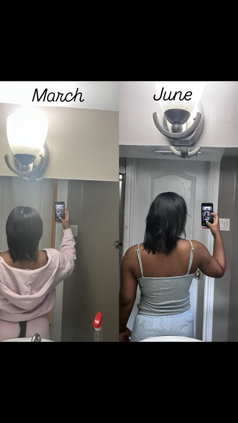 Customer photo review of “The Original” Hair Flourishing Capsule