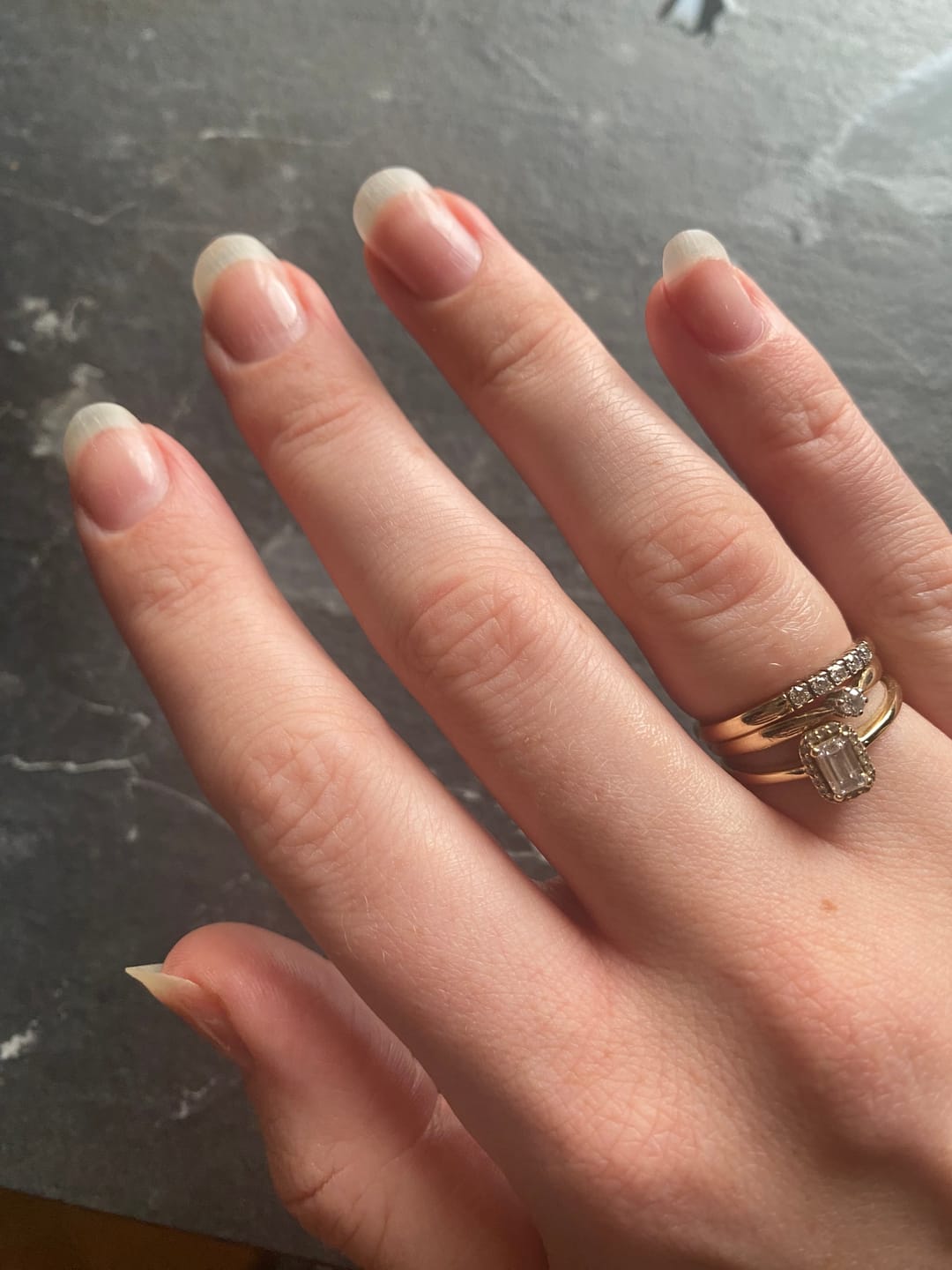 Customer photo review of Alua™- Collageen Proteine
