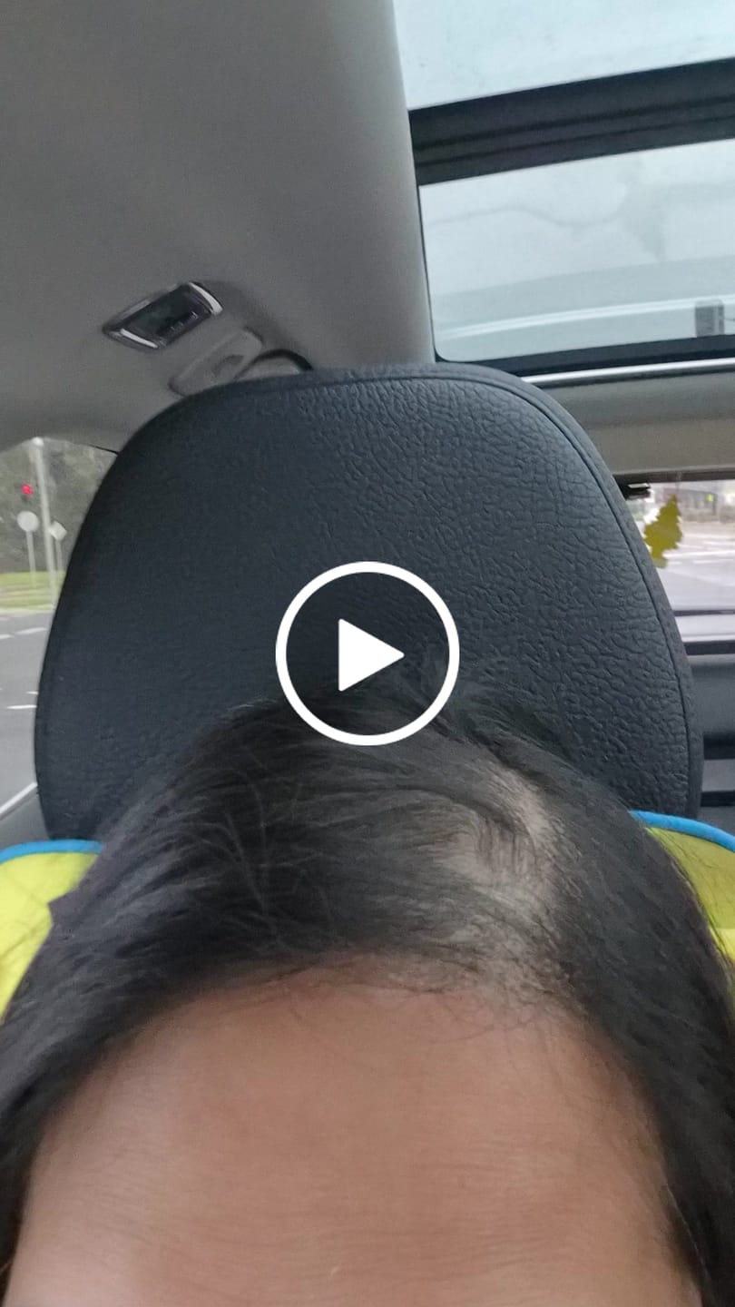 Customer video review of Mini Hair Topper #1B Natural Black