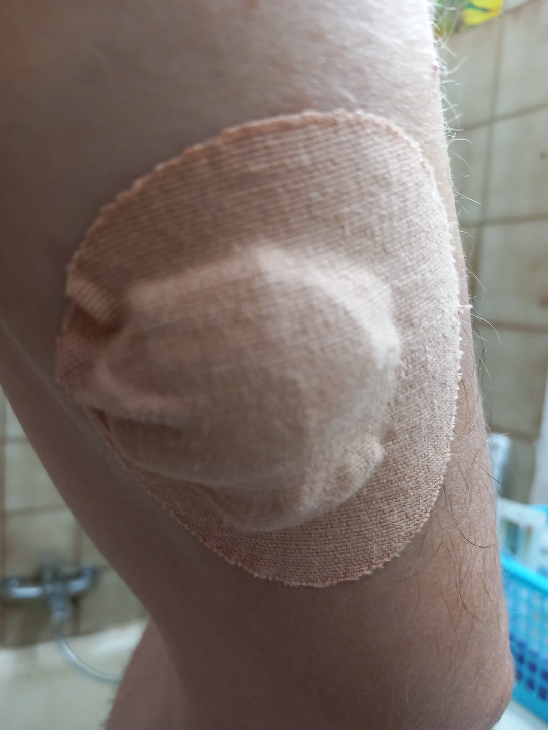 Customer photo review of Original Patch גוף 20 יח׳