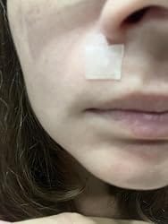 Customer photo review of DermaSeal™ - Parche Anti-Granos en Rollo