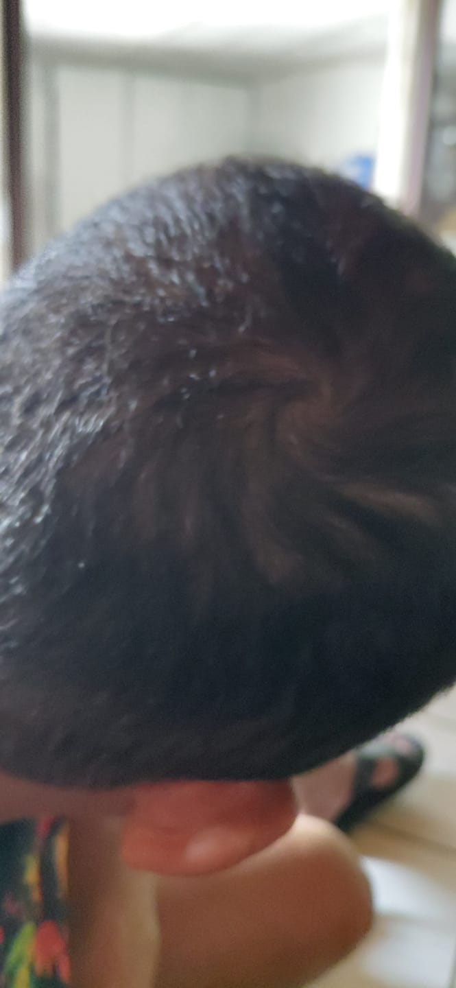 Customer photo review of Kit Anti-Chute Cheveux Homme | Odin - Max Barber