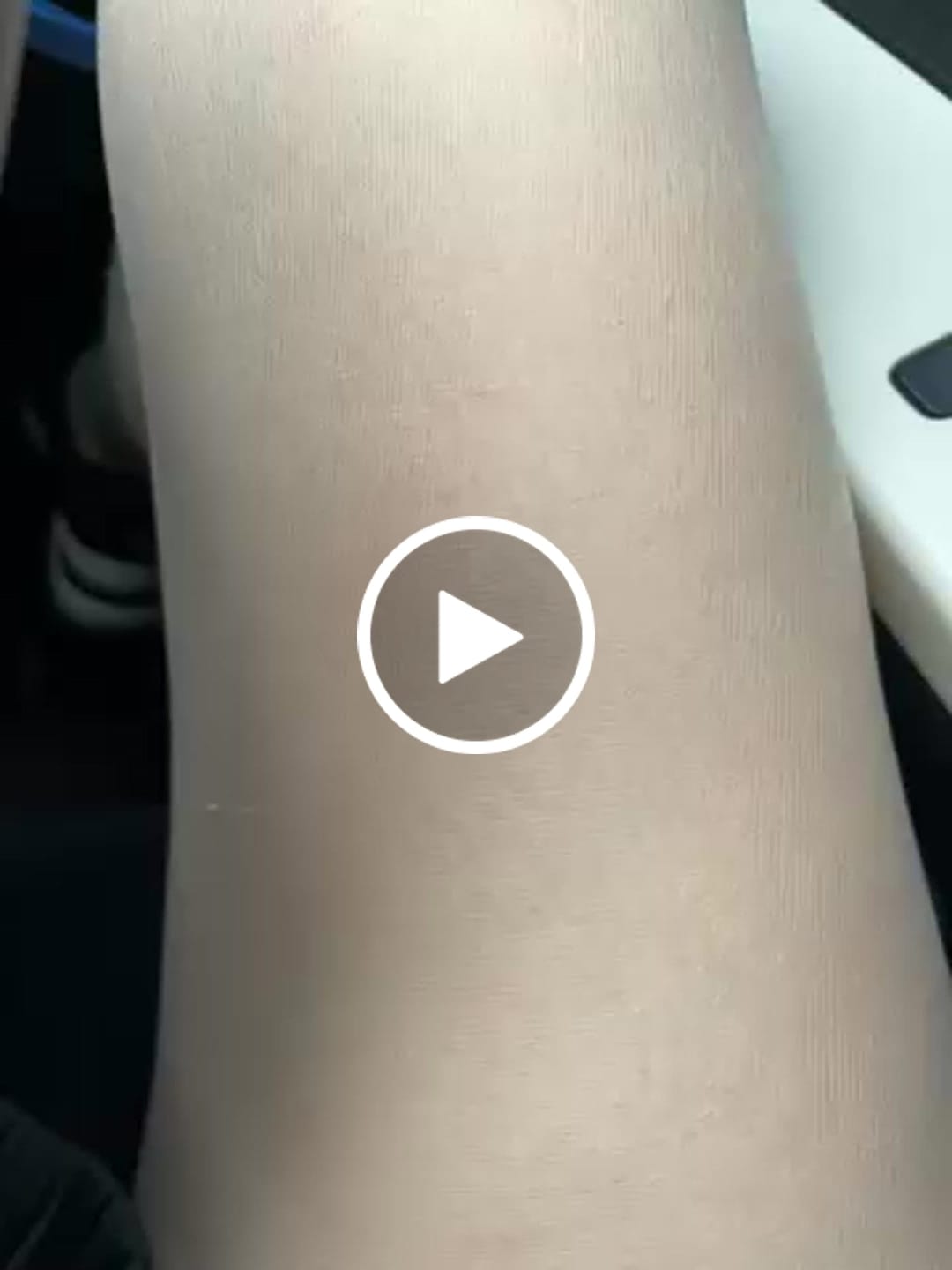 Customer video review of オンライン診療｜マンジャロ（2.5mg×4本）GIP/GLP-1【業界最安値14,980円】