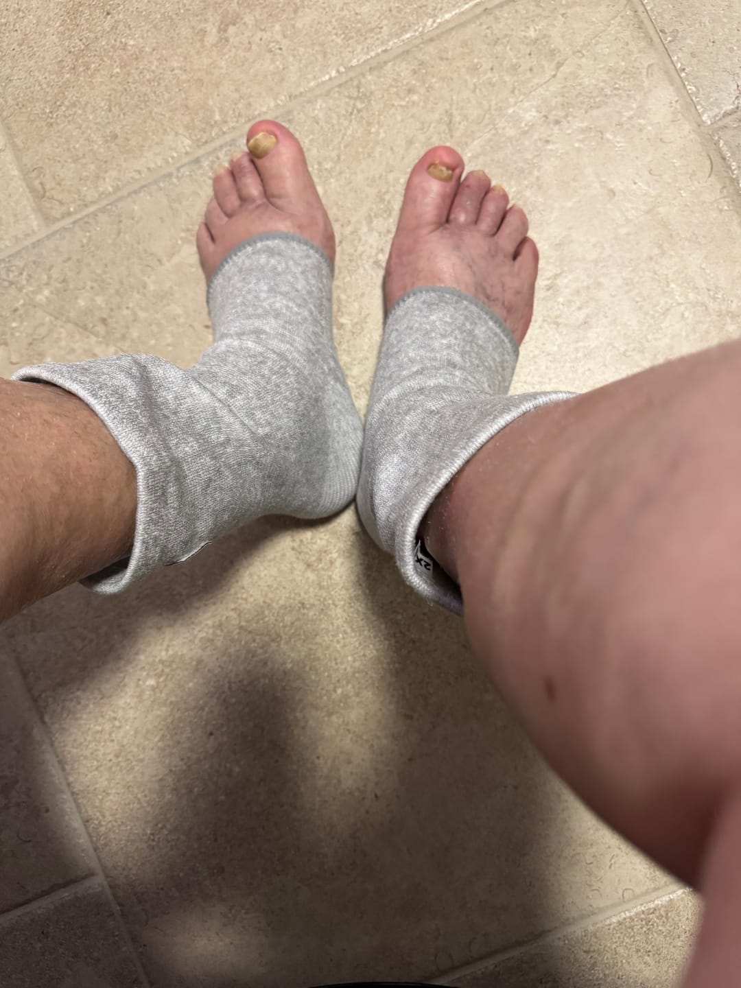 Customer photo review of Premium Anti-Fatigue Bamboo Footsleeves