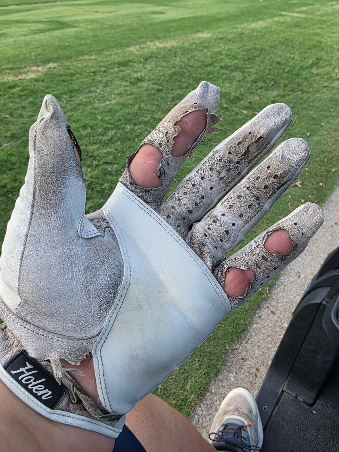 Customer photo review of Holen SureGrip Glove