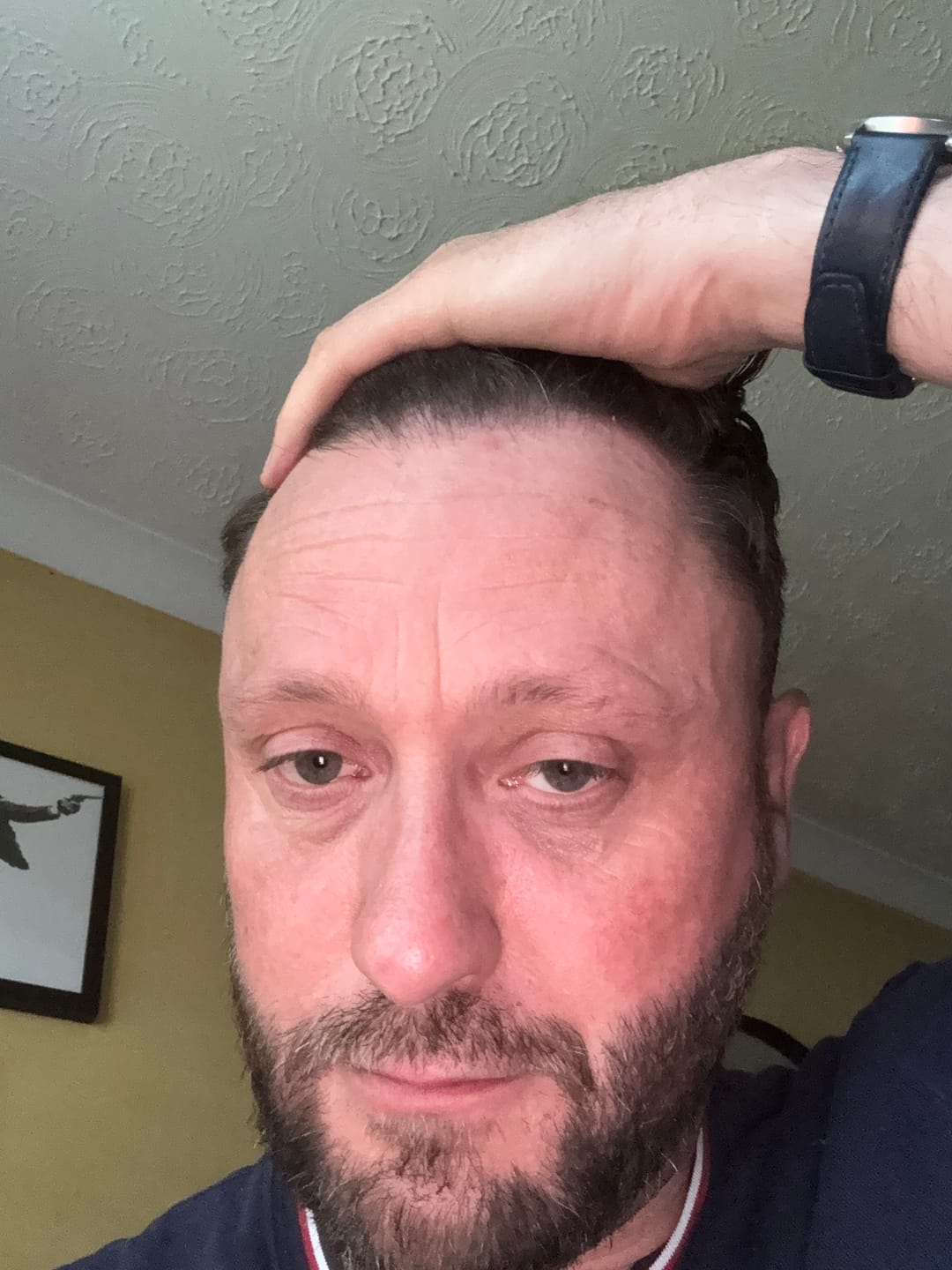 Customer photo review of Seb Natural Calming Serum