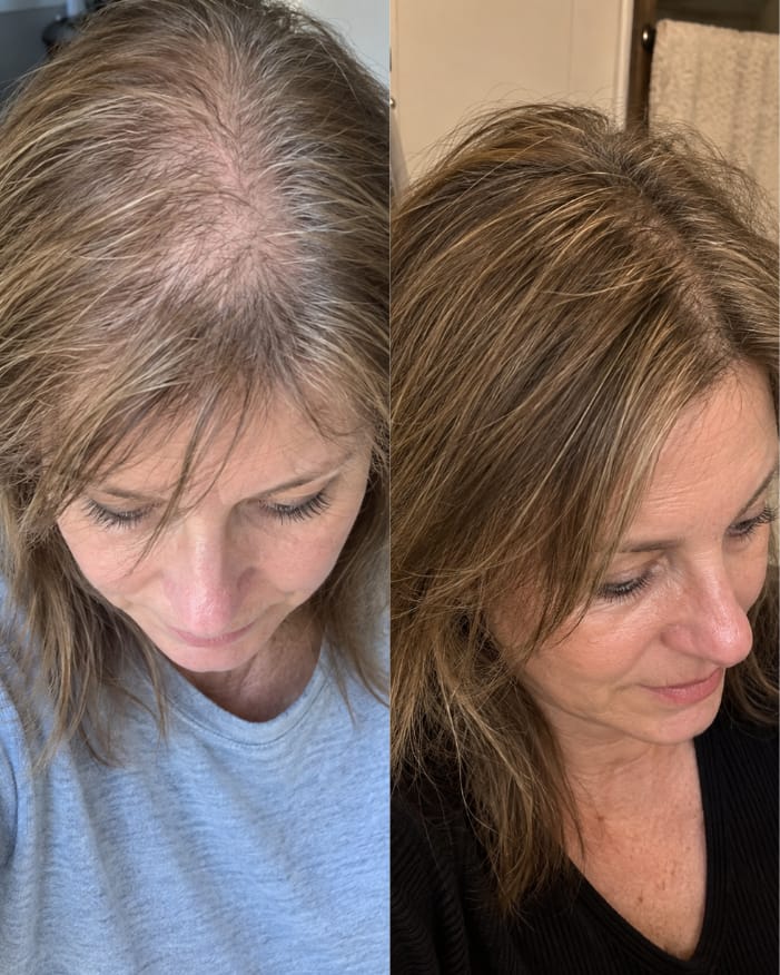 Customer photo review of KosmaHair Sérum | Restaurador Capilar & Entradas